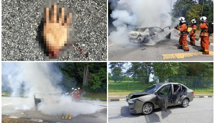 A severed human hand was discovered at the Tanjung Rambutan car fire scene
