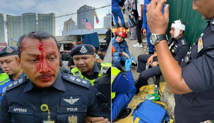 Dang Wangi police chief ACP Sulizmie Affendy Sulaiman was injured during a clash with Kampung Sungai Baru